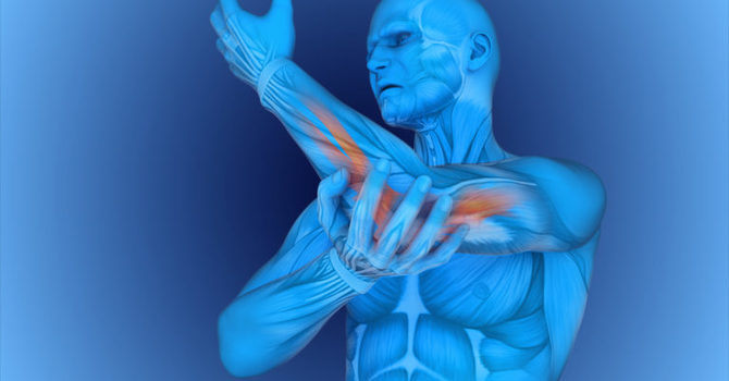 Tennis Elbow: What is it? How it happens? And What to do about it? image