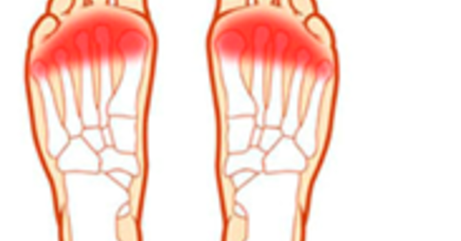 Why are My Toes Numb? image