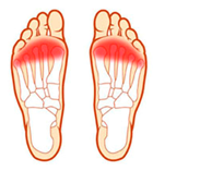 Illustration of numb spots on toes
