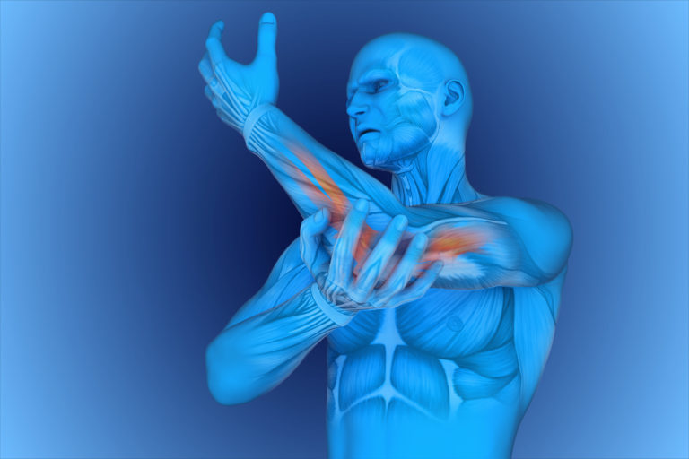 3D rendering of tennis eblow muscle areas