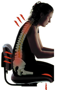 Illustration of poor sitting posture