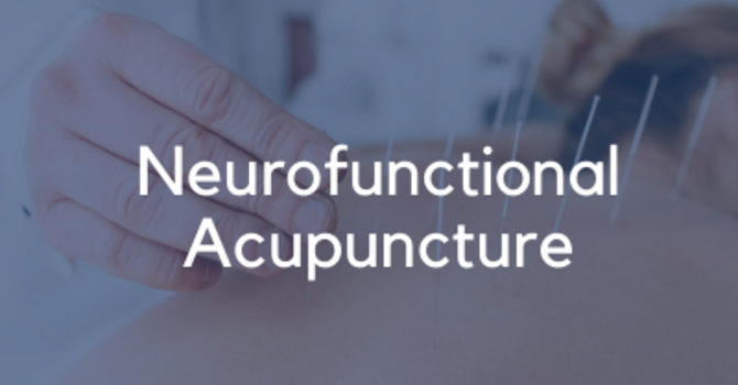 Neurofunctional Acupuncture